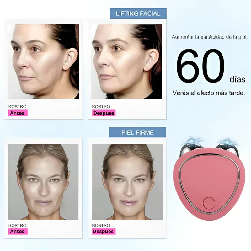 Masajeador facial microcorriente + Gel aloe vera (GRATIS)🌺