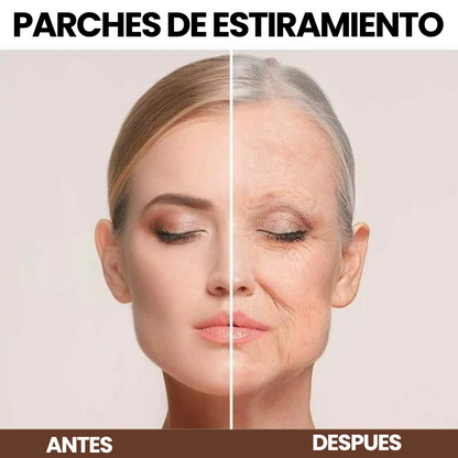 2 CAJAS DE 100 PARCHES ESTIRAMIENTO FACIAL⭐⭐⭐
