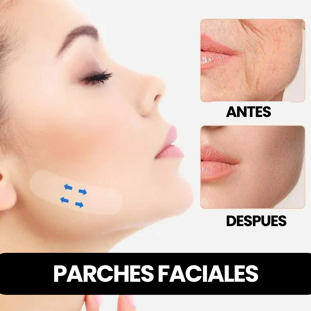 2 CAJAS DE 100 PARCHES ESTIRAMIENTO FACIAL⭐⭐⭐