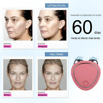 Masajeador facial microcorriente + Gel aloe vera (GRATIS)🌺