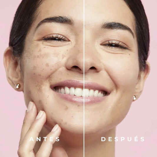 CREMA ACLARANTE-ORIGINAL🫧